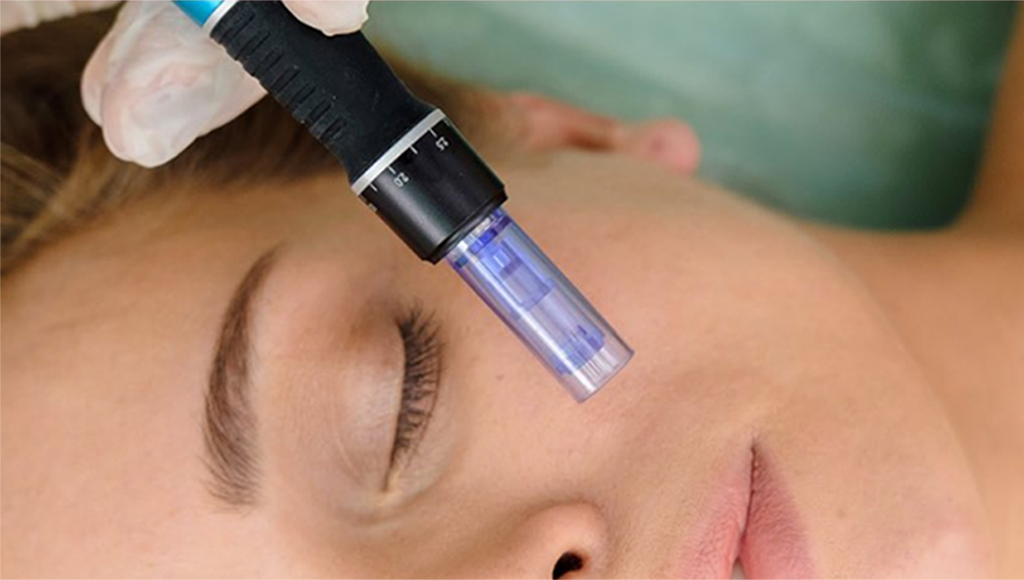 facial_dermapen_exosomas3 1