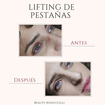 lifting_pestanas 29 12 2025